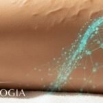 Cellulogia: Unlocking the New Era of Cellulite Treatment and Body Confidence 3 Cellulogia