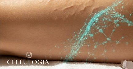Cellulogia