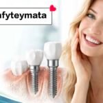 emfyteymata: A Modern Solution for Restoring Your Smile and Oral Health 3 emfyteymata